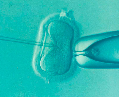 Gestación Subrogada Fecundación Invitro